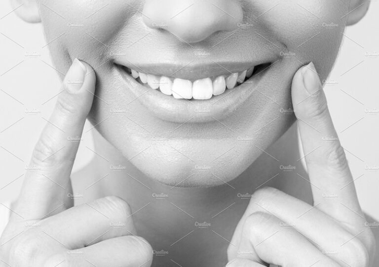 Wstawienie trzech implantów - przed